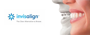 Invisalign-1-page-001